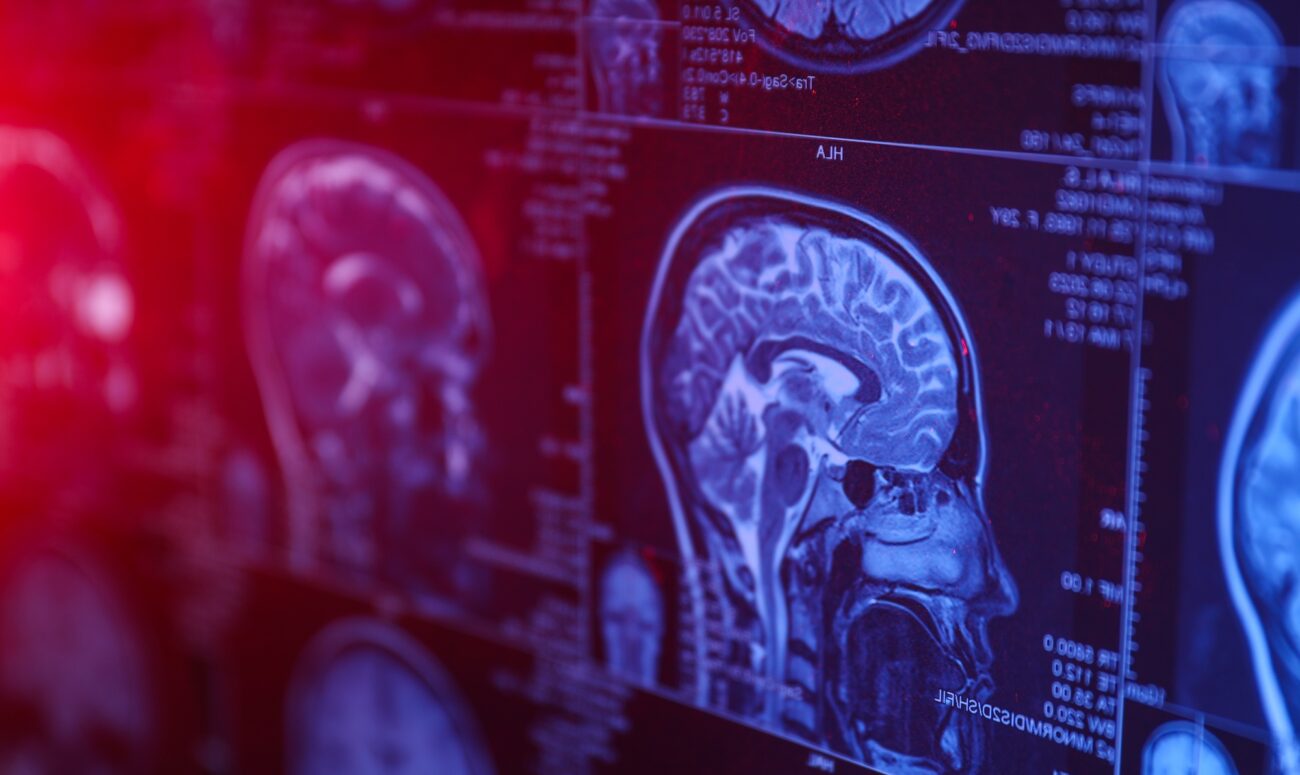 TG-IIC Da Fratura ao Fractal: a gênese da Teoria Geral do Inconsciente Informacional Computacional